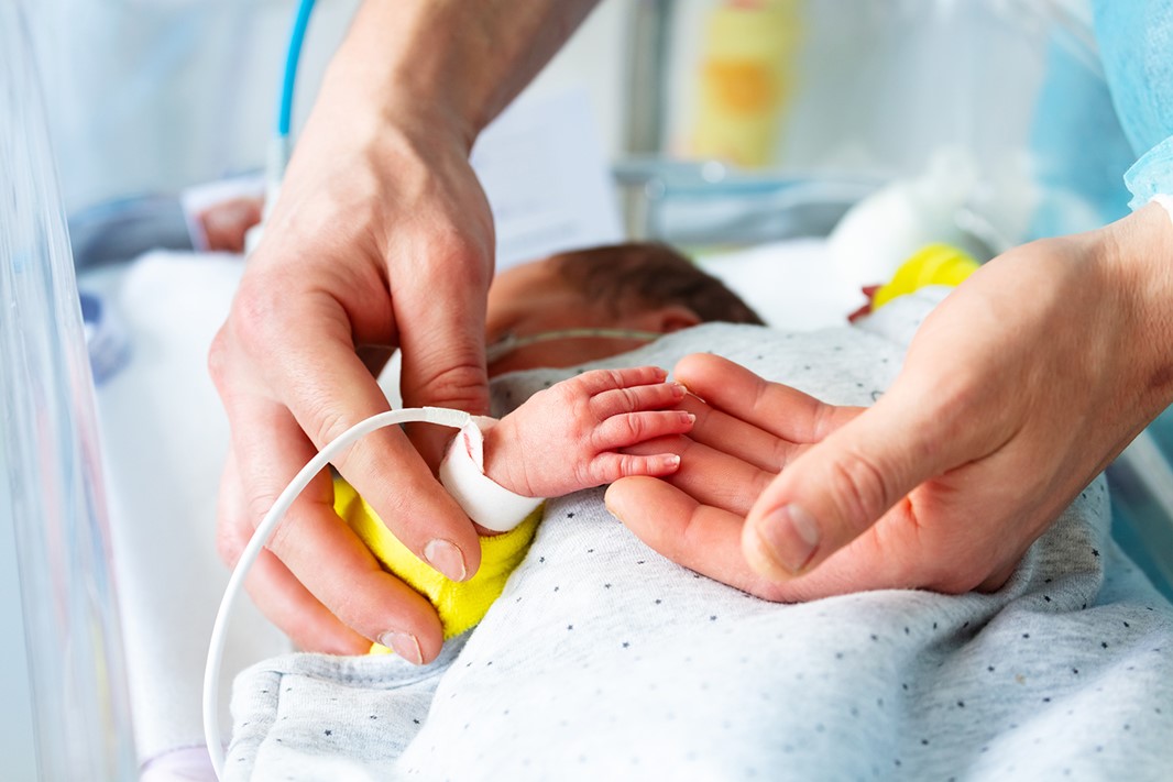 Hand och ett för tidigt fött spädbarn på en intensivvårdsavdelning (IVA) på sjukhus, med monitor